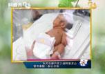 健康快报：山东首例胎儿宫内输血完成成功分娩——健康男婴